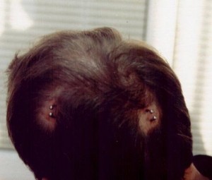 El Piercing se sube a la cabeza