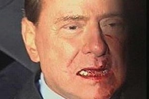 Agreden a Berlusconi y pierde 2 dientes Agreden a Berlusconi y pierde 2 dientes