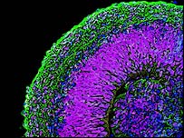 MInicerebros creados con células madre
